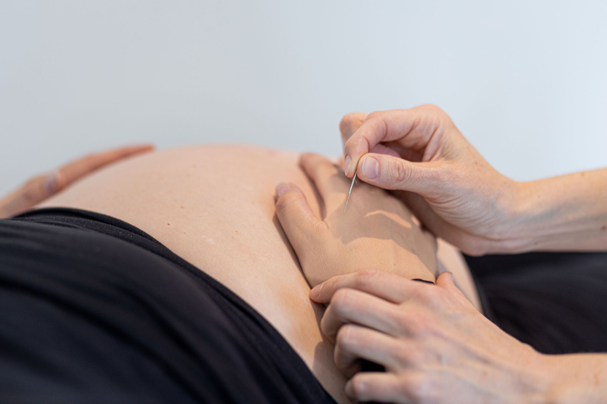Hænder holder en nål, der udfører akupunktur på en gravid mave. Baggrunden er en lys, udefineret væg.